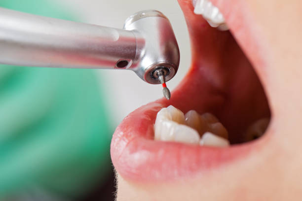 Best Emergency Treatment for Jaw Pain or Injury in Blacksburg, VA